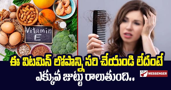 Correct this vitamin deficiency or you will experience more hair loss