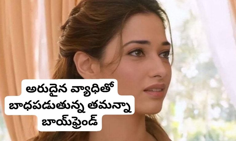 అరుదైన వ్యాధితో బాధపడుతున్న తమన్నా బాయ్‌ఫ్రెండ్